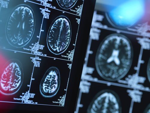 Brain scans of possible disease or damage in clinic