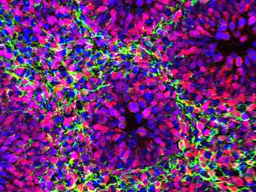 organoid - 16 9 ratio.jpg