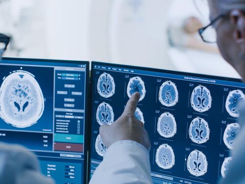 Men in hospital gear looking at a brain scan