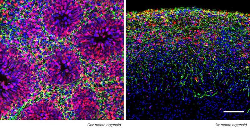 Two images. One on the left is a of organoids at 1 month. The image on the rights shows them at 6 months.